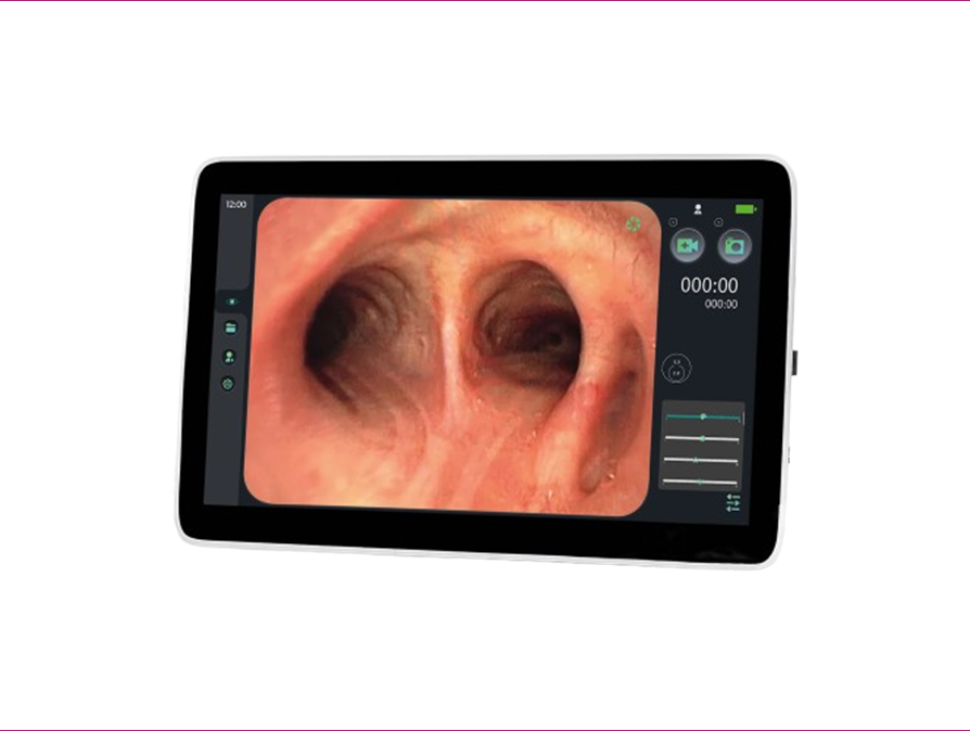 SISTEMA ENDOSCOPIA EICKVIEW SD